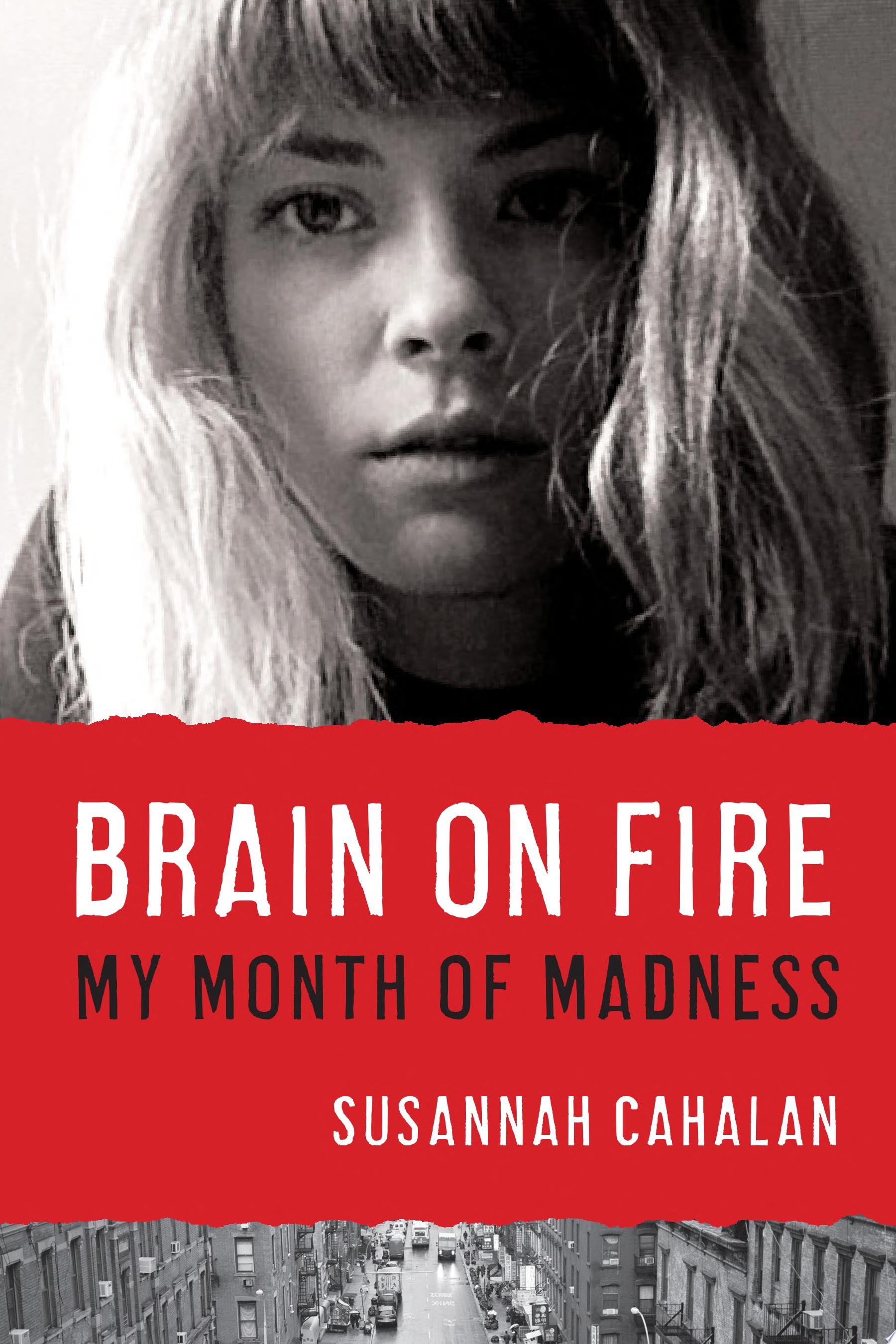 Image for "Brain on Fire"